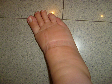 foot after salsa class